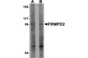 Western blot analysis of FRMPD2 in rat kidney tissue lysate with FRMPD2 antibody at (A) 1 and (B) 2 μg/ml.