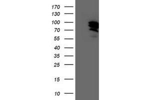 Western Blotting (WB) image for anti-General Transcription Factor IIF, Polypeptide 1, 74kDa (GTF2F1) antibody (ABIN1500596) (GTF2F1 anticorps)