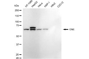 Western blotting analysis using GNE antibody (ABIN7798731).