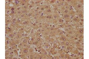 IHC image of ABIN7149404 diluted at 1:300 and staining in paraffin-embedded human liver tissue performed on a Leica BondTM system.