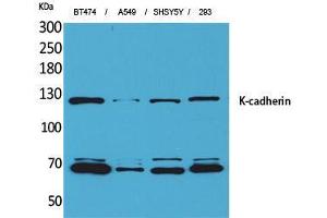 Western Blot (WB) analysis of BT474, A549, SHSY5Y, 293 cells using K-cadherin Polyclonal Antibody. (CDH6 anticorps  (Internal Region))