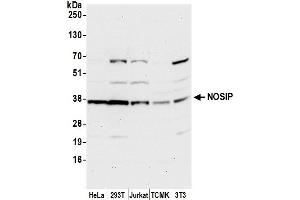 Western Blotting (WB) image for anti-Nitric Oxide Synthase Interacting Protein (NOSIP) (AA 251-301) antibody (ABIN7450503)