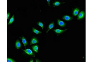 Immunofluorescent analysis of A549 cells using ABIN7149021 at dilution of 1:100 and Alexa Fluor 488-congugated AffiniPure Goat Anti-Rabbit IgG(H+L) (ATG4B anticorps  (AA 350-400))