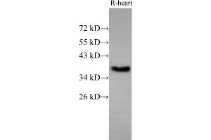 Western Blot analysis of Rat Heart using EpCAM Polyclonal Antibody at dilution of 1:500 (EpCAM anticorps)