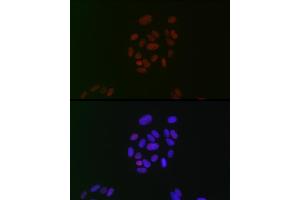 Immunofluorescence analysis of U-2 OS cells using CIRBP Rabbit mAb (ABIN7266452) at dilution of 1:100 (40x lens).