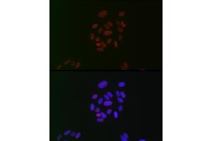 Immunofluorescence analysis of U-2 OS cells using CIRBP Rabbit mAb (ABIN7266452) at dilution of 1:100 (40x lens). (CIRBP anticorps)