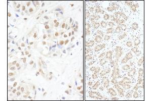 Immunohistochemistry (IHC) image for anti-V-Myb Myeloblastosis Viral Oncogene Homolog (Avian) (MYB) (AA 1-50) antibody (ABIN7453466)