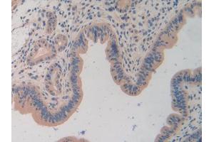 DAB staining on IHC-P; Samples: Mouse Uterus Tissue (TOR1A anticorps  (AA 41-333))