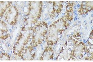 Immunohistochemistry of paraffin-embedded Mouse kidney using MTHFD2 Polyclonal Antibody at dilution of 1:100 (40x lens).