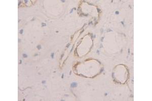 Figure. (PMP22 anticorps  (AA 31-133))