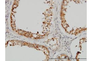 Immunoperoxidase of monoclonal antibody to SDSL on formalin-fixed paraffin-embedded human testis.
