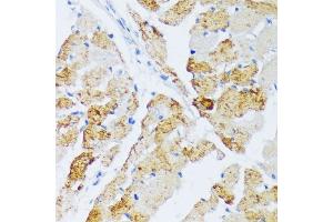 Immunohistochemistry of paraffin-embedded rat heart using WSB2 antibody (ABIN6133280, ABIN6150269, ABIN6150270 and ABIN6216800) at dilution of 1:100 (40x lens).