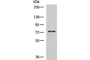 Western blot analysis of Rat liver tissue lysate using TGFBI Polyclonal Antibody at dilution of 1:850 (TGFBI anticorps)