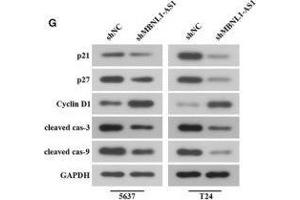 Inhibition of MBNL1-AS1 promoted the tumorigenesis of BC cells through the regulation of miR-135a/PHLPP2/FOXO1 in vivo. (Cyclin D1 anticorps  (AA 96-295))