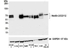 Western Blotting (WB) image for anti-Poliovirus Receptor-Related 2 (Herpesvirus Entry Mediator B) (PVRL2) (AA 50-100) antibody (ABIN7449542)