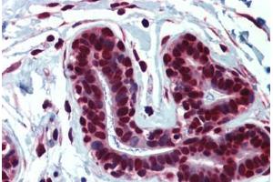 Human Breast: Formalin-Fixed, Paraffin-Embedded (FFPE)