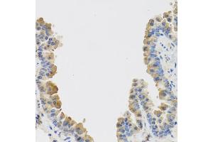 Immunohistochemistry of paraffin-embedded mouse lung using IL25 antibody (ABIN5974535) at dilution of 1/100 (40x lens). (IL-25 anticorps)