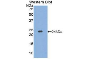 Western Blotting (WB) image for anti-Dishevelled Segment Polarity Protein 1 (DVL1) (AA 150-332) antibody (ABIN3202637) (DVL1 anticorps  (AA 150-332))