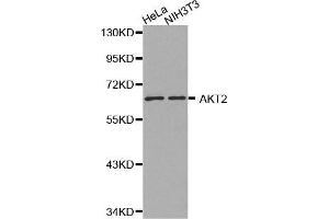 Western Blotting (WB) image for anti-V-Akt Murine Thymoma Viral Oncogene Homolog 2 (AKT2) antibody (ABIN3020945) (AKT2 anticorps)
