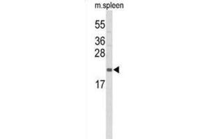 Western Blotting (WB) image for anti-Interleukin 31 (IL31) antibody (ABIN3004157) (IL-31 anticorps)
