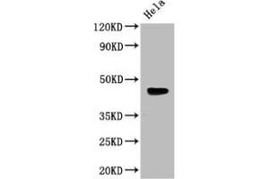 Western Blot Positive WB detected in: Mouse heart tissue All lanes: WNT5A antibody at 3 μg/mL Secondary Goat polyclonal to rabbit IgG at 1/50000 dilution Predicted band size: 43, 41 kDa Observed band size: 43 kDa