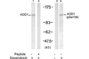 Image no. 2 for anti-Adducin 1 (Alpha) (ADD1) (pSer726) antibody (ABIN196918) (alpha Adducin anticorps  (pSer726))