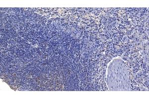Detection of FASL in Human Spleen Tissue using Polyclonal Antibody to Factor Related Apoptosis Ligand (FASL) (FASL anticorps  (AA 102-280))