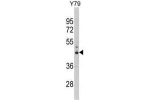 Western blot analysis of PSMD13 Antibody (C-term) in Y79 cell line lysates (35ug/lane). (PSMD13 anticorps  (C-Term))