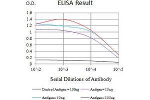Black line: Control Antigen (100 ng),Purple line: Antigen (10 ng), Blue line: Antigen (50 ng), Red line:Antigen (100 ng)