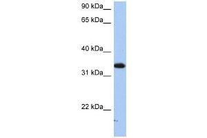 SULT6B1 antibody used at 1 ug/ml to detect target protein.