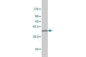 Western Blot detection against Immunogen (36. (ARF5 anticorps  (AA 81-180))