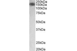 Western Blotting (WB) image for anti-Myosin Light Chain Kinase (MYLK) (Internal Region) antibody (ABIN2465035) (MYLK anticorps  (Internal Region))