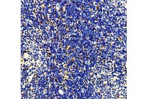 IHC analysis of MTA2 using anti-MTA2 antibody (ABIN7599519). (MTA2 anticorps  (AA 1-668))