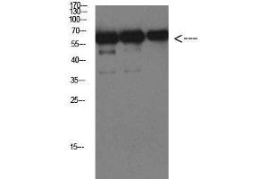 Western Blot analysis of Luciferase protein using Luciferase Monoclonal Antibody at dilution of 1:1000. (Luciferase anticorps)