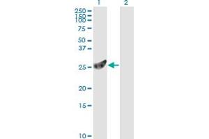 Western Blot analysis of PSMA7 expression in transfected 293T cell line by PSMA7 monoclonal antibody (M01), clone 1A10-3G12.