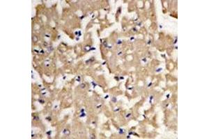 IHC analysis of FFPE heart tissue stained with LC3A antibody. (MAP1LC3A anticorps  (AA 30-56))