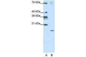WB Suggested Anti-SRP19  Antibody Titration: 1. (SRP19 anticorps  (Middle Region))