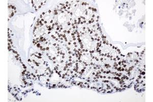 Image no. 2 for anti-Proliferating Cell Nuclear Antigen (PCNA) antibody (ABIN1500061) (PCNA anticorps)