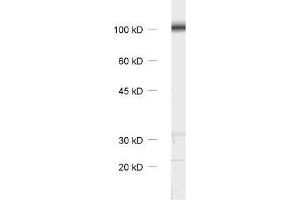Western Blotting (WB) image for anti-Catenin, beta (CATNB) (AA 768-782) antibody (ABIN1742544) (beta Catenin anticorps  (AA 768-782))