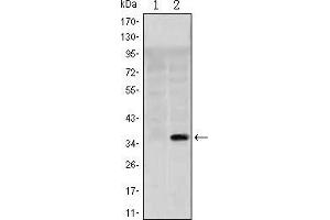 Western blot analysis using SLC22A1 mAb against HEK293 (1) and SLC22A1(AA: 284-347)-hIgGFc transfected HEK293 (2) cell lysate. (SLC22A1 anticorps)