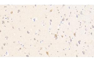 Detection of PURA in Human Cerebellum Tissue using Polyclonal Antibody to Purine Rich Element Binding Protein A (PURA) (PURA anticorps  (AA 1-322))