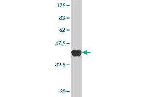 Western Blot detection against Immunogen (37. (Syndetin/VPS50 anticorps  (AA 862-964))