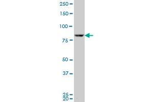 RPS6KA3 polyclonal antibody (A01), Lot # 060707JCS1 Western Blot analysis of RPS6KA3 expression in SJCRH30 .