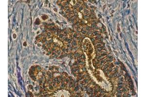 Anti-Rab11a antibody IHC Staining of human mammary tissue, Immunohistochemistry of formalin-fixed, paraffin-embedded tissue after heat-induced antigen retrieval, antibody concentration 1/200, (RAB11A anticorps  (C-Term))