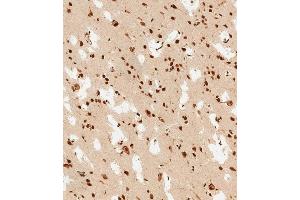 (ABIN6243826 and ABIN6578813) staining PSMD3 in human brain tissue sections by Immunohistochemistry (IHC-P - paraformaldehyde-fixed, paraffin-embedded sections).