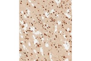 (ABIN6243826 and ABIN6578813) staining PSMD3 in human brain tissue sections by Immunohistochemistry (IHC-P - paraformaldehyde-fixed, paraffin-embedded sections). (PSMD3 anticorps  (AA 482-515))