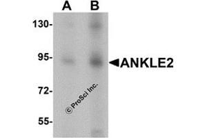 Western Blotting (WB) image for anti-Ankyrin Repeat and LEM Domain Containing 2 (ANKLE2) (Middle Region) antibody (ABIN1030852) (ANKLE2 anticorps  (Middle Region))