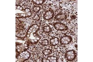 Immunohistochemical staining of human colon with FAM103A1 polyclonal antibody  shows strong nuclear positivity in glandular cells at 1:1000-1:2500 dilution. (FAM103A1 anticorps)