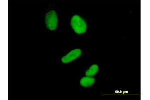 Immunofluorescence of purified MaxPab antibody to CCNH on HeLa cell. (Cyclin H anticorps  (AA 1-323))