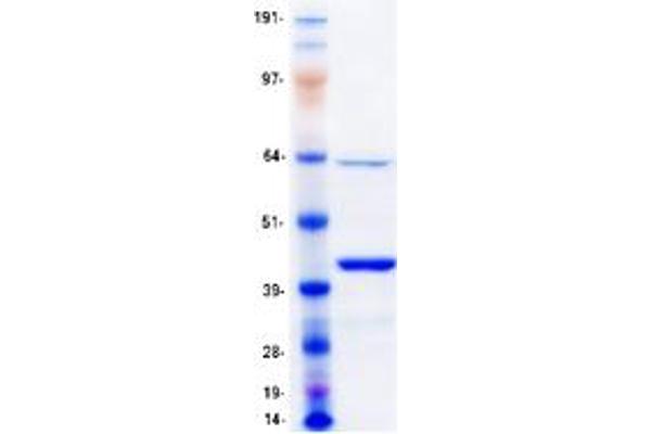 MBNL1 Protein (Transcript Variant 6) (Myc-DYKDDDDK Tag)